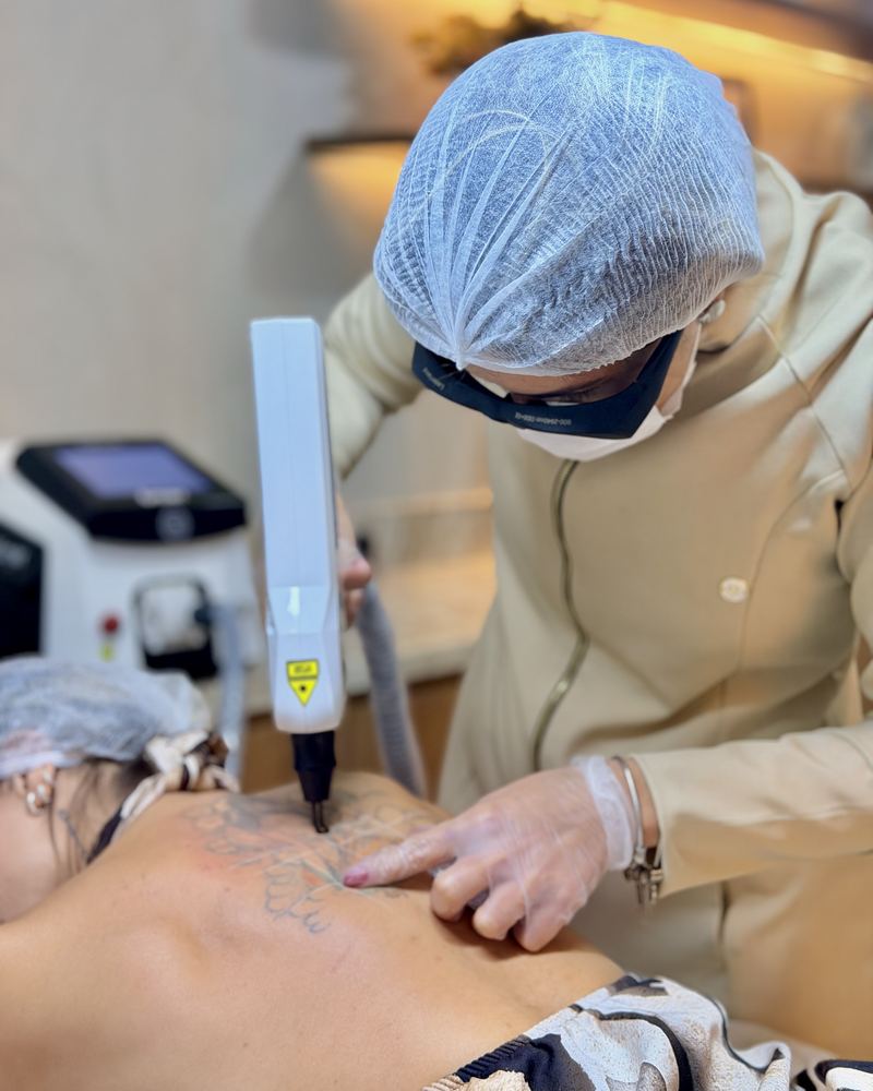 Mércia aplicando o laser em uma tatuagem, com touca, máscara e óculos de proteção