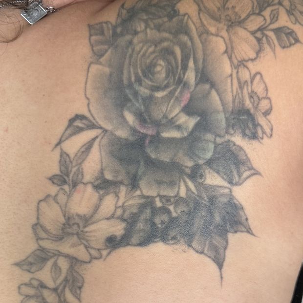 Tatuagem floral nas costas antes do início da remoção
